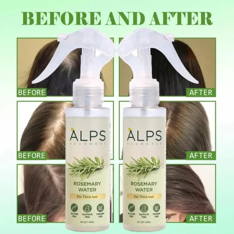 Rosemary Water Spray by APLS – 2 Pack (100ml Each) | Revitalizing Skin & Hair Care Mist